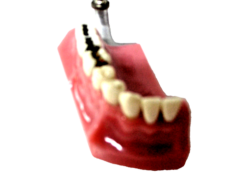 Dental Typodont Teeth Model Half mouth Orthodontist Teaching Vintage Model 571 - 第 6/7 張圖片
