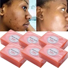 6/5 x Kojic Acid Soap Acne Dark Spots Removal Skin Whitening Bleaching Soap