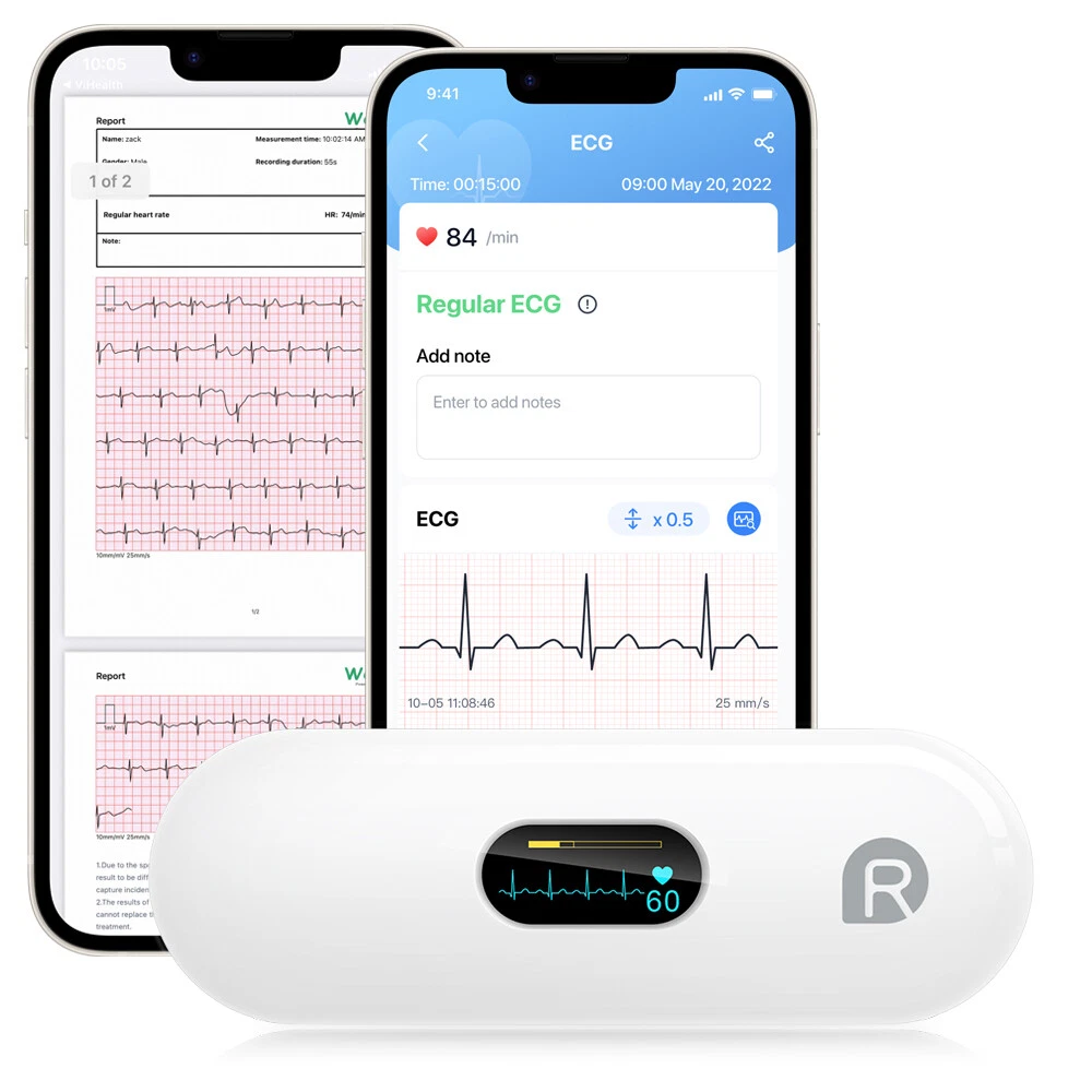 EKG ECG Monitor Heart Rate Monitor Smartphone free APP 30s 5mins ECG Recording