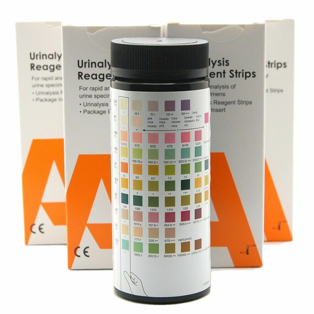 Blood in Urine Tests Kidney Infection 10 Parameter Strips ALLTEST