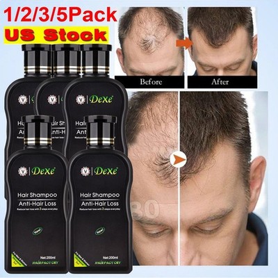 1-5Bottles Dexe Anti Hair Loss Hair Shampoo Chinese Herbal Hair Growth Shampoo