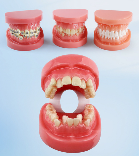 MODELO TIPODONCIA DENTAL Dislocación dental Expositor restauración ortodoncia - Imagen 2 de 19