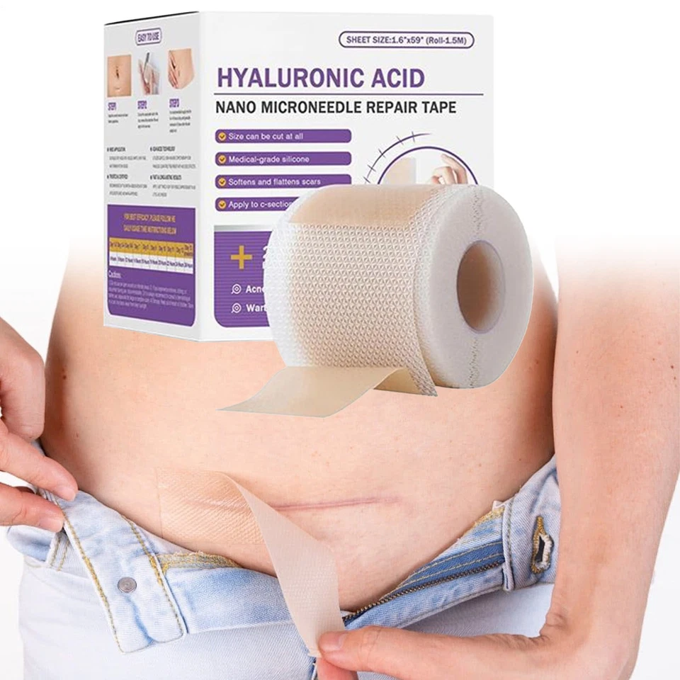 Hyaluronic Acid Silicone Scar Sheets,Silicone Scar Tape Soft & Comfortable Sheet - Image 4 of 4