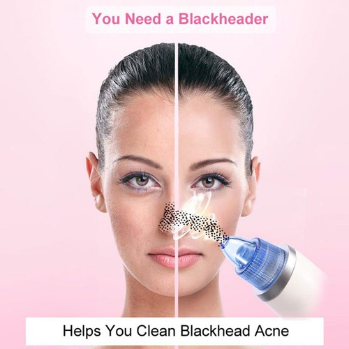 Diamond Blackhead Vacuum Suction Removal Face Cleaner Skin Care Beauty Device - Picture 16 of 24
