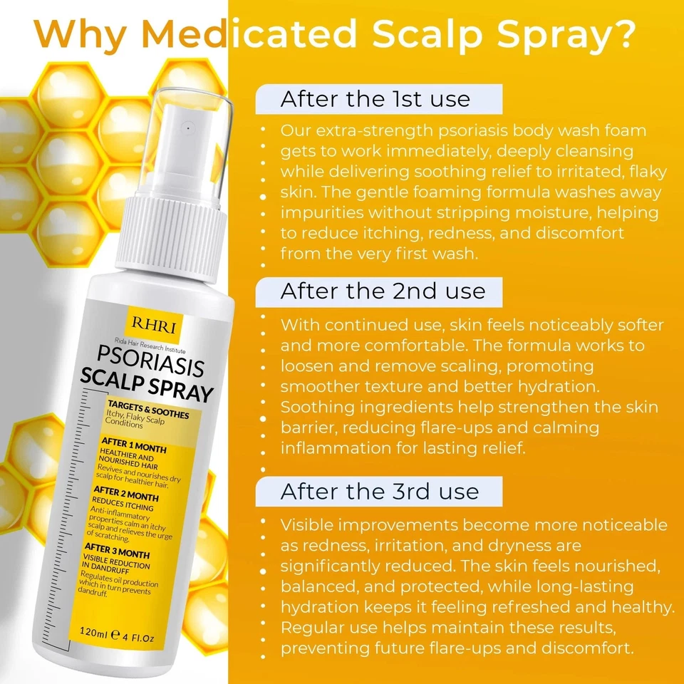 Spray para psoriasis cuero cabelludo | Tratamiento para psoriasis y caspa para la infección por levaduras del cuero cabelludo... Foto 4 de 4