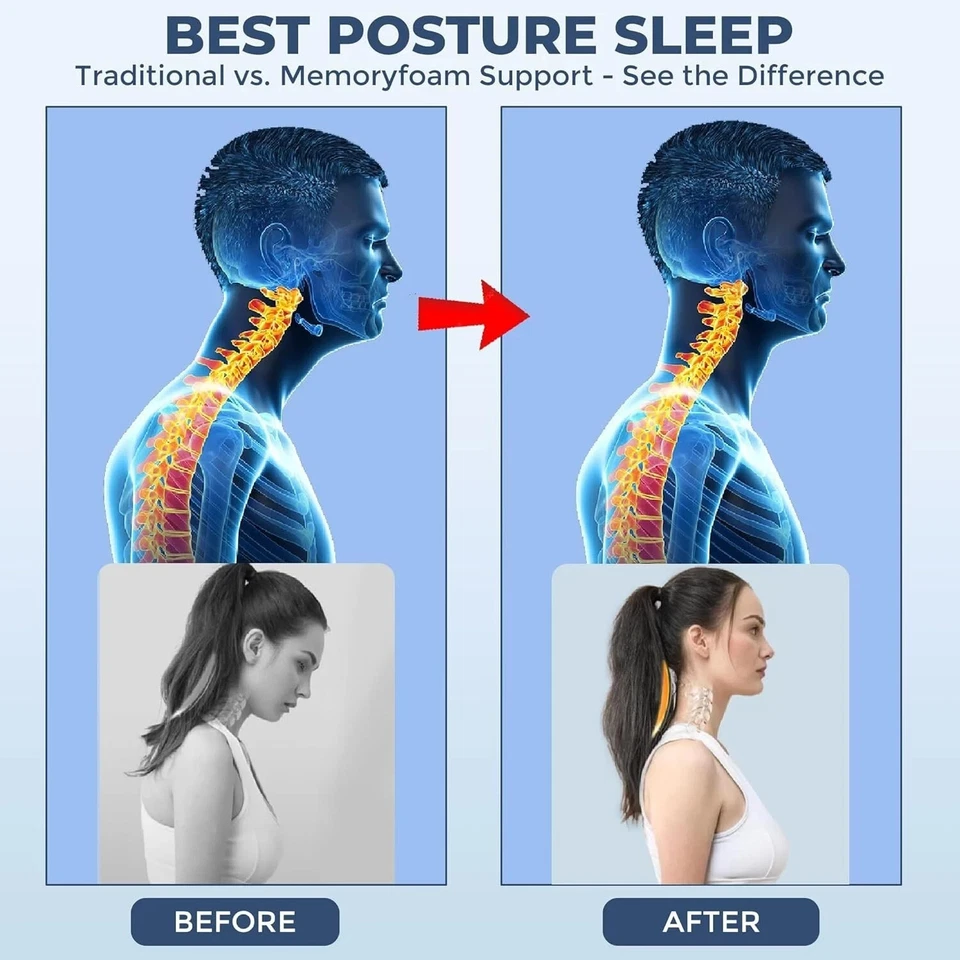 Ergonomic Memory Foam Pillow For Cervical Neck Shoulder Orthopedic Pain Relief - Image 3 of 4