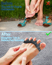 4PCS Silicone Toe Separators Spacers for Kids, Bunion Corrector for Overlappi...