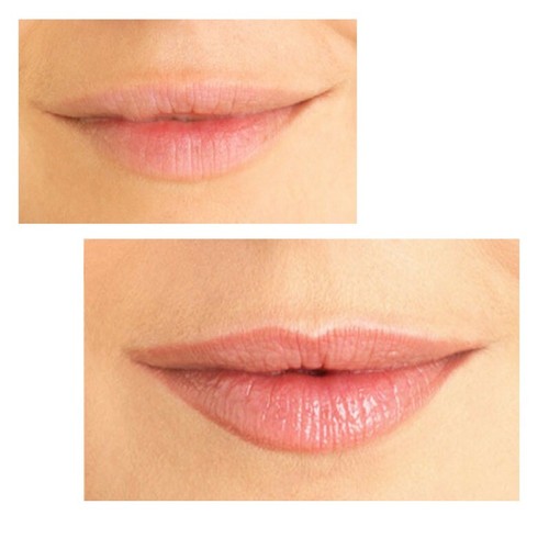Biotouch SILVERA 1 PRONG sterilisierte Einweg Nadelkartuschen Microblading - Bild 5 von 7