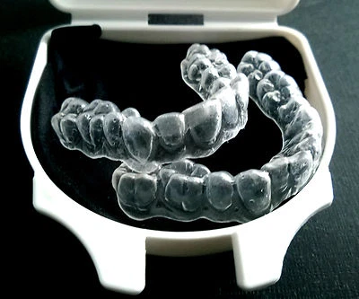 Teeth Whitening / Bleaching Trays Custom Fit