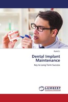 Rohit S. | Dental Implant Maintenance | Taschenbuch | Englisch (2021)