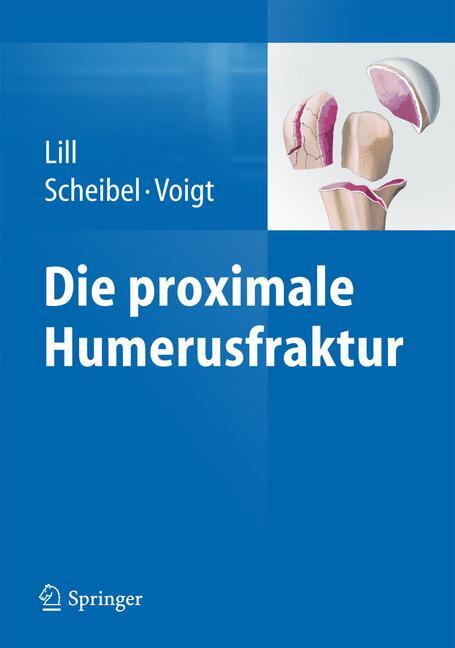 Thumbnail - Die Proximale Humerusfraktur Helmut Lill