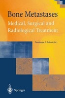 Bone Metastases Dominique G. Poitout