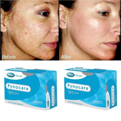 X2 Pynocare White Herbal Natural Vitamin Skin Care Anti Melasma Reduce Dark Spot