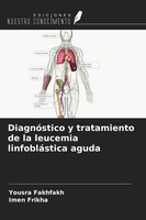 Yousra Fakhfakh (U. A.) | DiagnóStico Y Tratamiento De La Leucemia...