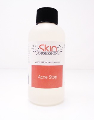 4 oz Acne Stop ~Skin Obsession~ Excellent Acne & Blemish Skin Care Product!!
