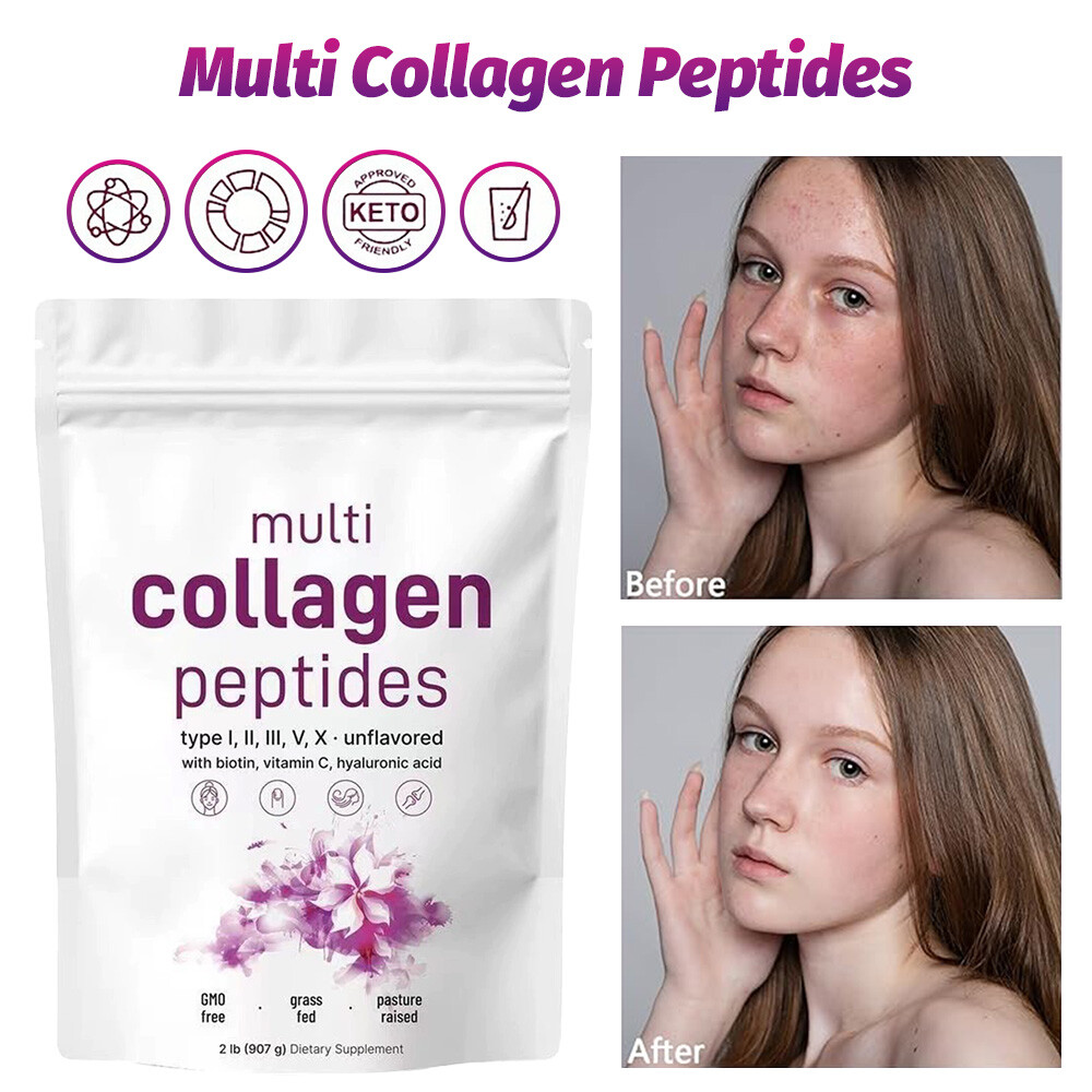 Multi Collagen Peptides Powder - Hydrolyzed Protein for Type I, II, III, V, X Support
