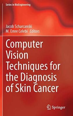 Computer Vision Techniques for the Diagnosis of Skin Cancer (New)