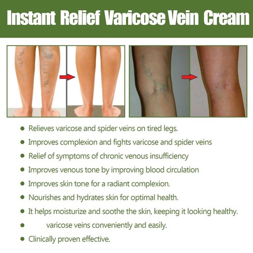 Melivu Varicose Cream, Melivu Instant Relief Varicose -Vein Cream - 50g Au - Picture 13 of 17