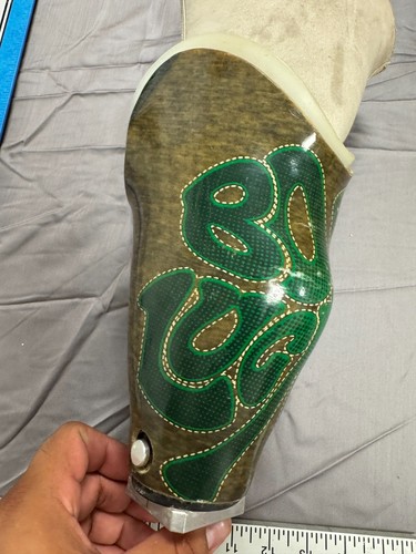 Custom Below Knee Prosthetic Socket “Born Lucky” Graphic ALPS Liner Trulife Adap