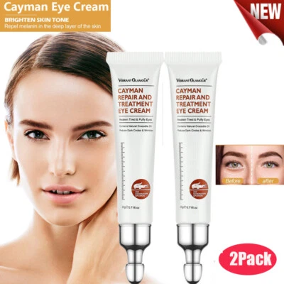 VIBRANT GLAMOUR 2X Magic Eye Cream Instant Remove Eye Bags&Dark Circles&Eye Wrinkles&Fine Lines