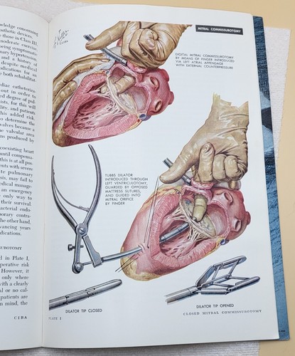 CIBA Clinical Symposia Medical Book Dr. Frank Netter Illustrations year 1969 - Bild 6 von 9