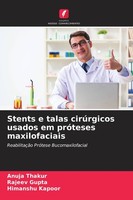 Stents E Talas CirúRgicos Usados ¿¿Em PróTeses Maxilofaciais Himanshu Kapoor