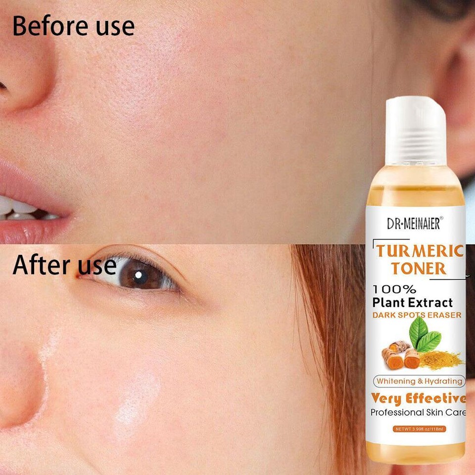 Turmeric Toner Dark Spots Facial Toner Spots Eraser Skin Spotless Dark