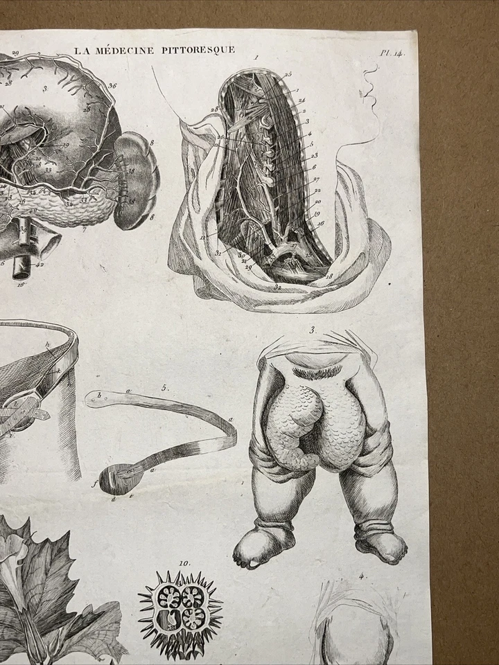 Antiquarische Radierung 1834 Anatomie Medizine Chirurgie Arzt Doktor Botanik - Bild 3 von 4