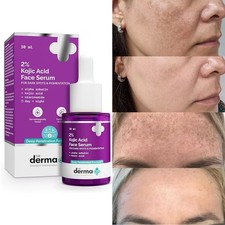 The Derma Co. 2 Kojic Acid Face Serum 30ml  Fights Pigmentation ETC.