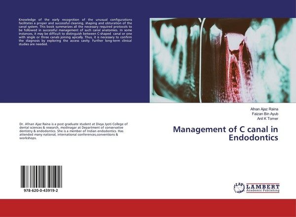 Management Of C Canal In Endodontics Faizan Bin Ayub-image