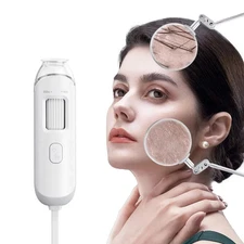 Handheld Dermatoscope,50X/200X Magnifying Mini Hair Scalp Detector Skin Analyzer