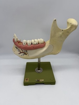 Vintage SOMSO Lower Jaw & Teeth Anatomy Model Medical Display