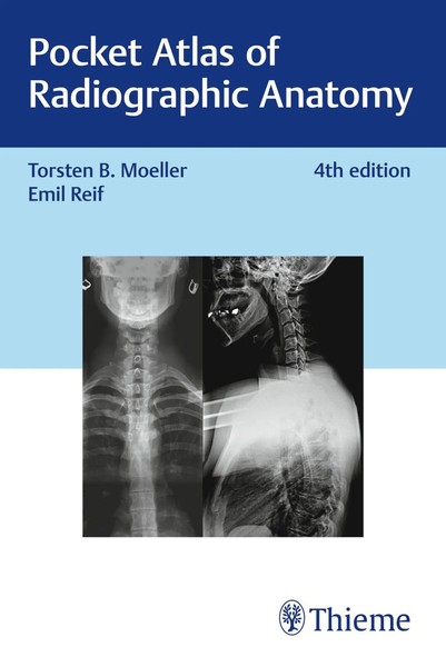 Torsten Bert MöLler (U. A.) | Pocket Atlas Of Radiographic Anatomy | Taschenbuch-image
