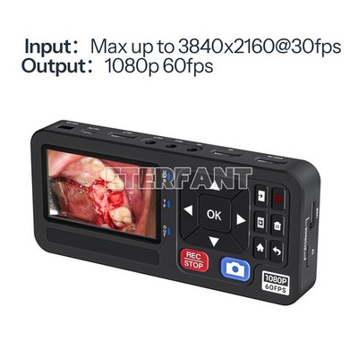 Portable Medical Surgical Recorder for Laparoscopy and Endoscopy Capture
