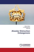 Afshan Afreen (U. A.) | Alveolar Distraction Osteogenesis | Taschenbuch (2021)