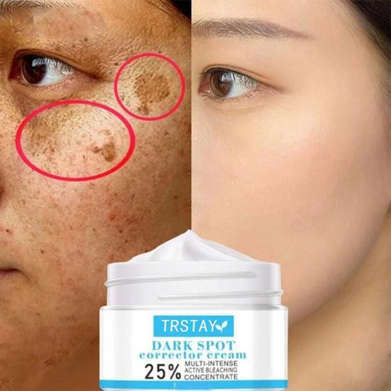 The best cream to remove dark spots on face online