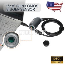 Surgery 1080p Full HD Inspection Laparoscopic Camera ENT Endoscopy TU-U1