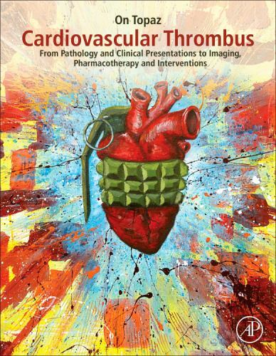 Cardiovascular Thrombus Topaz Hardback Academic Press 9780128126158