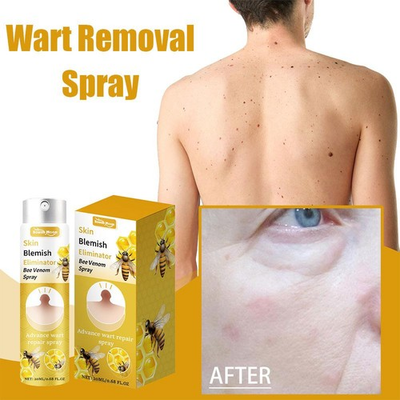 #ad .Tag Recede Bee Spray Bee Warts and Button Removal H9H9Best Treatment Z $6.35
