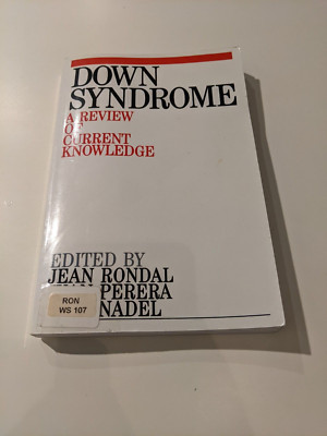 Down Syndrome A Review of Current Knowledge