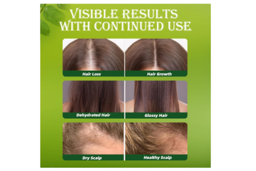 Batana Oil Shampoo Cleanser 100ml | Anti Hair Fall Solution | Hair Growth Boost - Picture 3 of 15