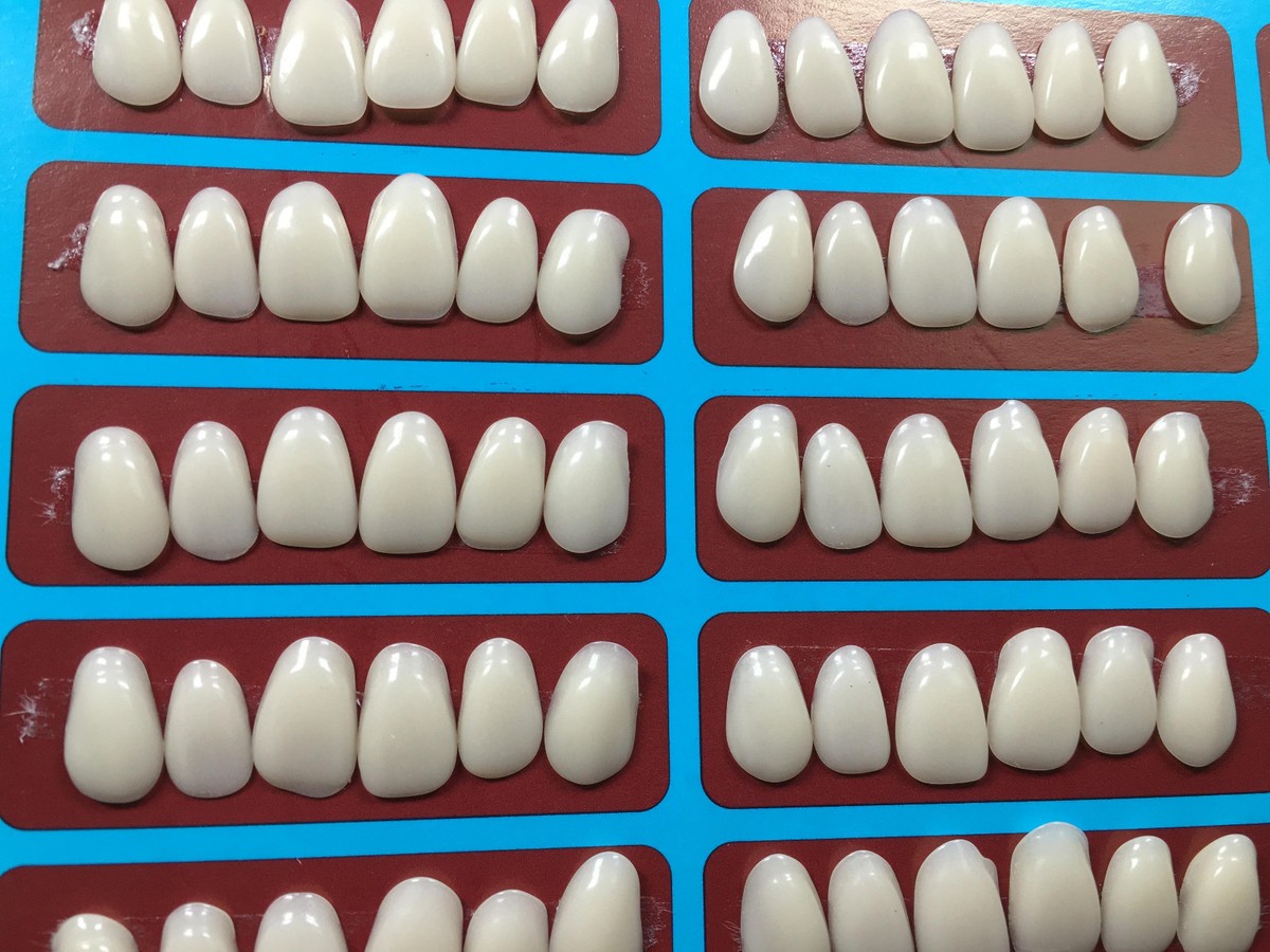 Denti Con Faccette, Faccette Dentali Bologna | Dr. Pier Carlo Frabboni - Foto 7