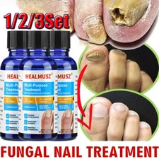 HEALMUSZ Fungal Nail Treatment for Toenail & Fingernails Repair Solution 30ml