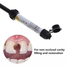 Teeth Resin Tooth Repair Dental Cement Cavity Filling Strong Repair Restoration