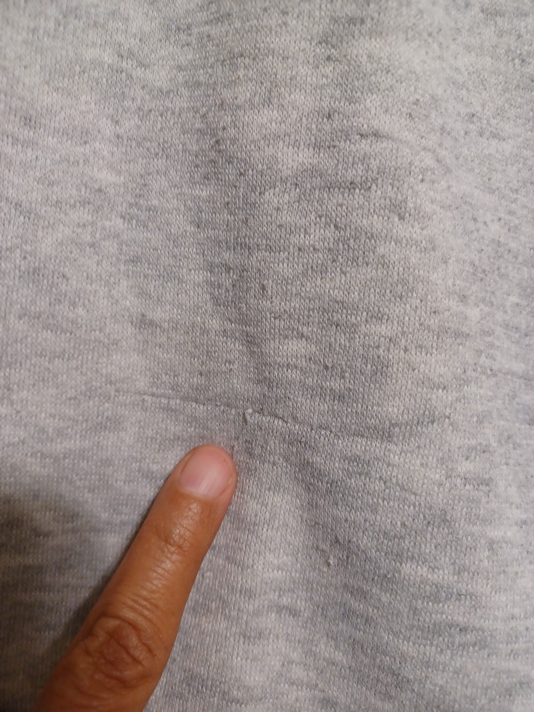 Picture 3 of 11