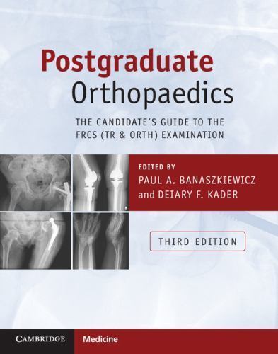 Postgraduate Orthopaedics: The Candidate's Guide to the FRCS (Tr & Orth) Examina
