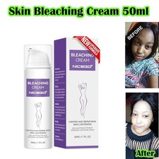 Whitening Cream For Removing Dark Knuckle Finger Elbow and Knee 50ml