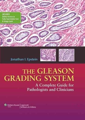 The Gleason Grading System: A Complete Guide for Pathologist and Clinicians by J