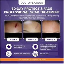 Advanced Scar Treatment with Silishield - 10g