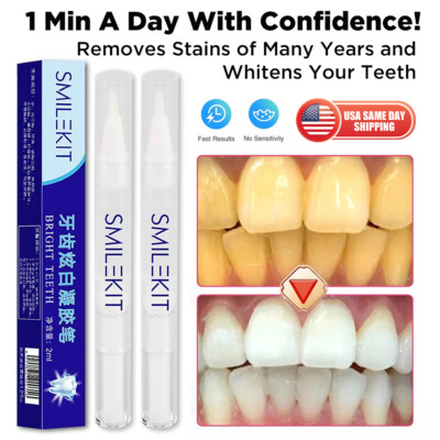 2x Mint Teeth Whitening Gel Pen Extra Strong White Hygiene Tooth Stain Removal